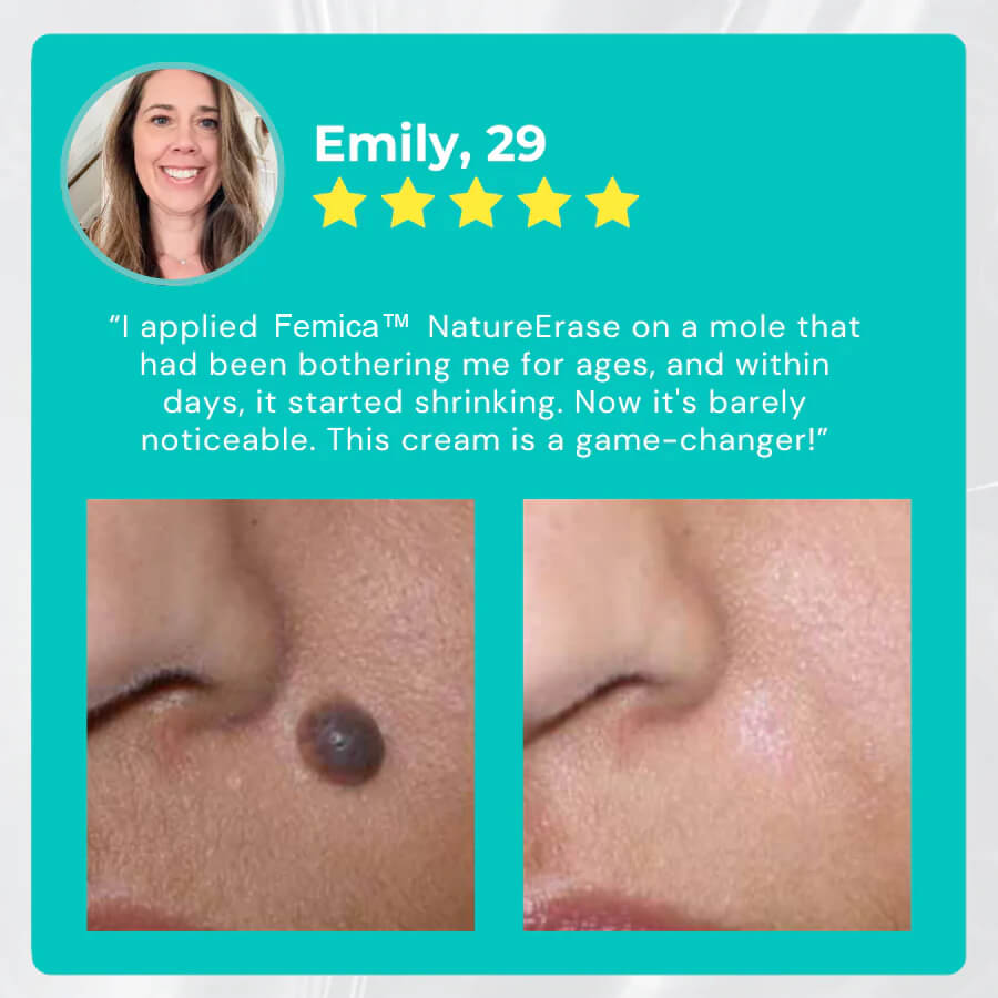 Femica™ NatureErase Instant Mole & Spot Cream
