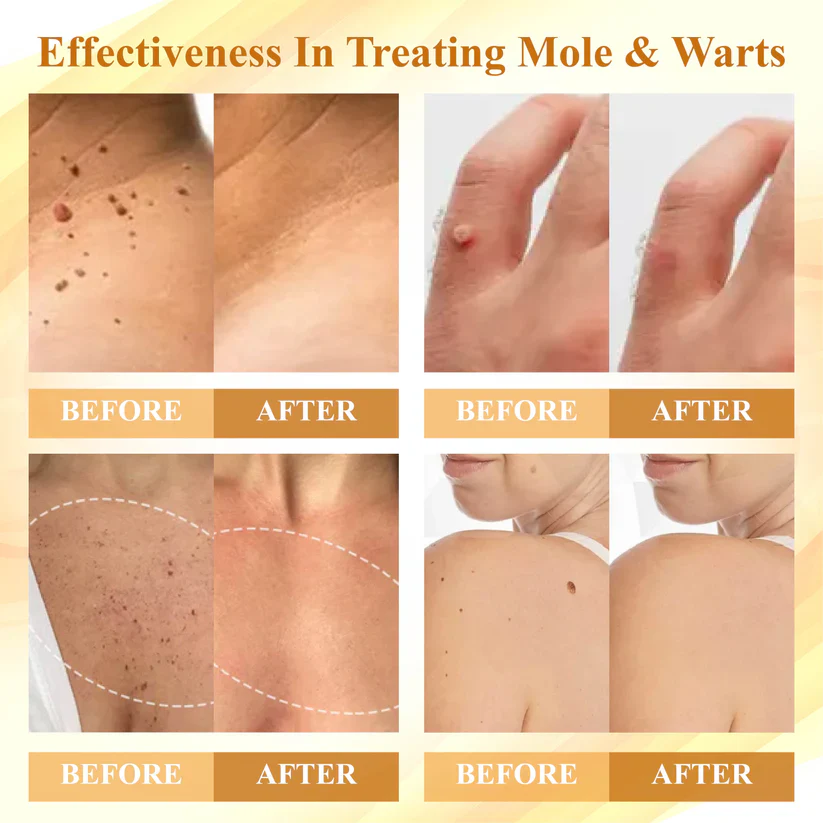 Kunauo™ Condense Mellifera Venom Skin Repairing Cream