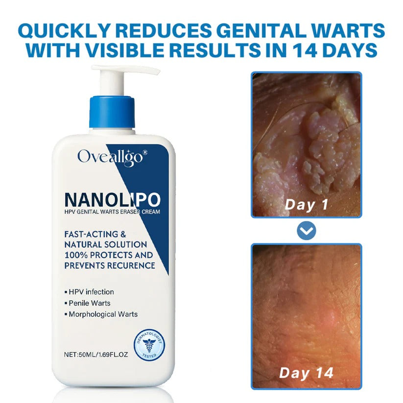 Oveallgo® NanoLipo HPV Genital Warts Eraser Cream