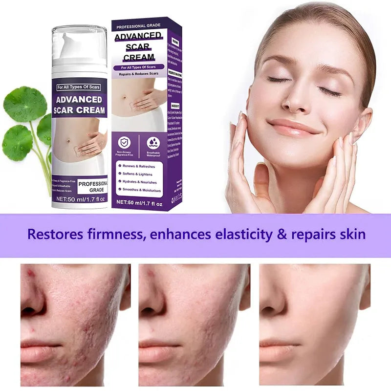 Kunauo™  Scar Removal Gel