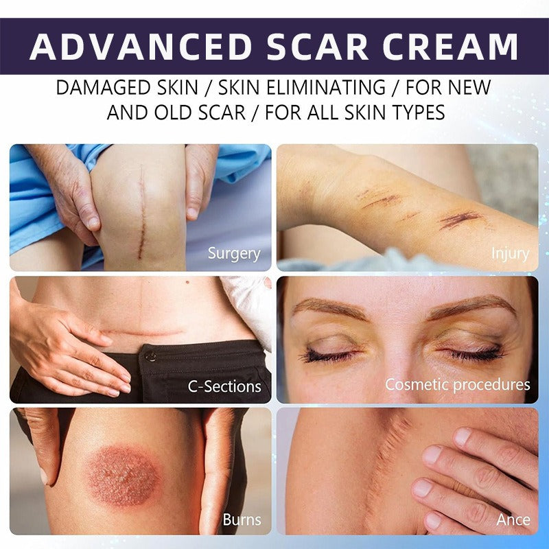 Kunauo™  Scar Removal Gel