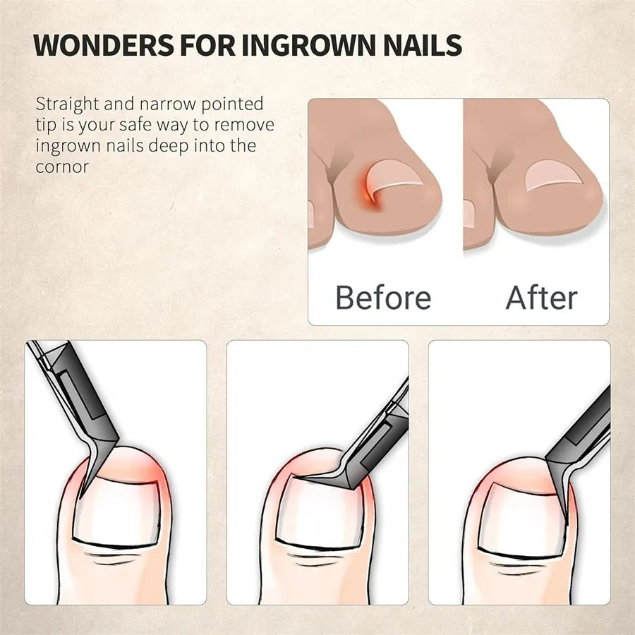 Kunauo™ Toenail Clipper Ingrown Nail Clipper