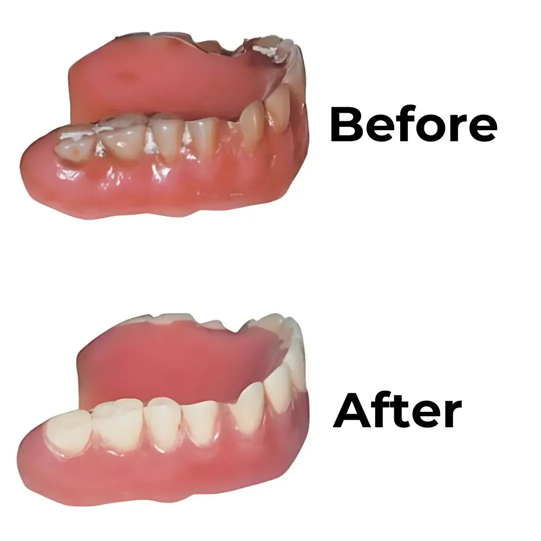 Denture Dome