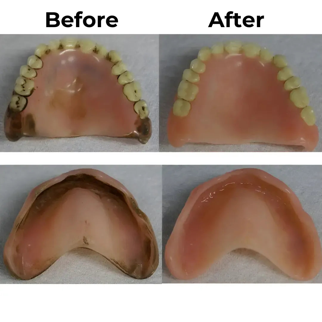 Denture Dome