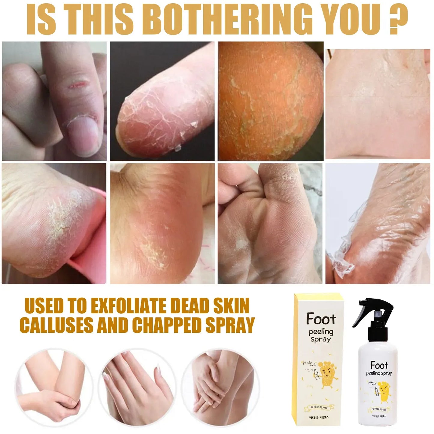 EELHOE™ Foot Peeling Spray