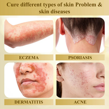 Kunauo™ Condense Mellifera Venom Skin Repairing Cream