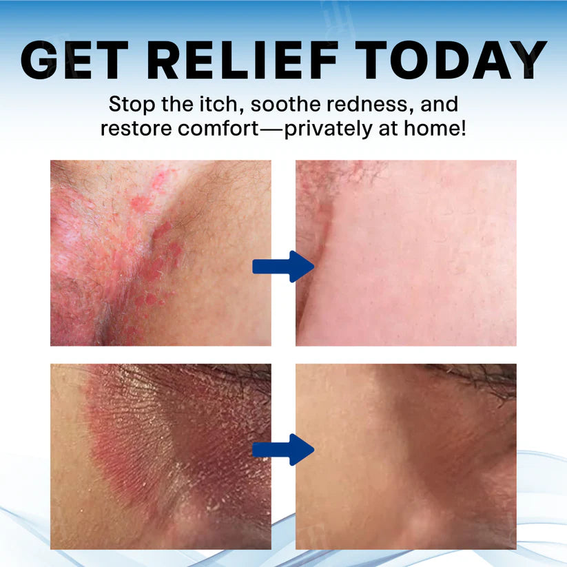 FIVFIVGO® Scrotum Itchy Treatment Cream