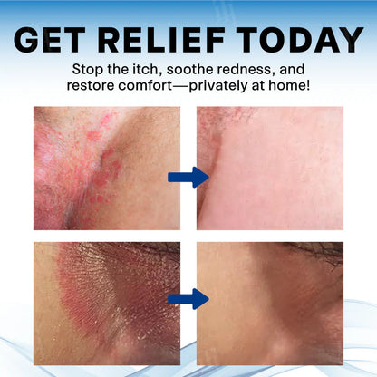 FIVFIVGO® Scrotum Itchy Treatment Cream