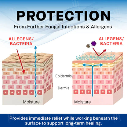 FIVFIVGO® Scrotum Itchy Treatment Cream