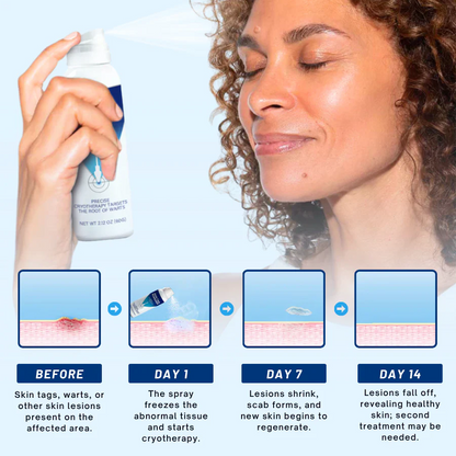 Kunauo™ TagRecede Cryo Treatment Spray