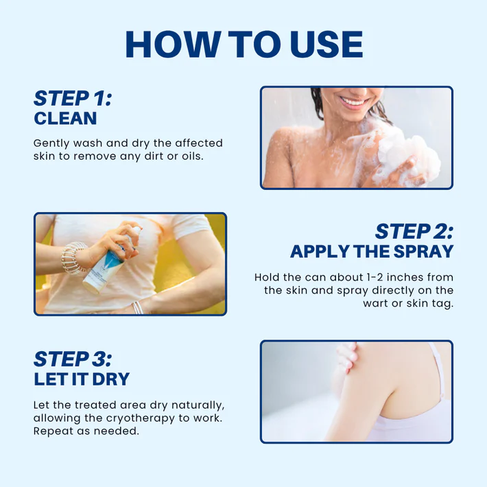 Kunauo™ TagRecede Cryo Treatment Spray