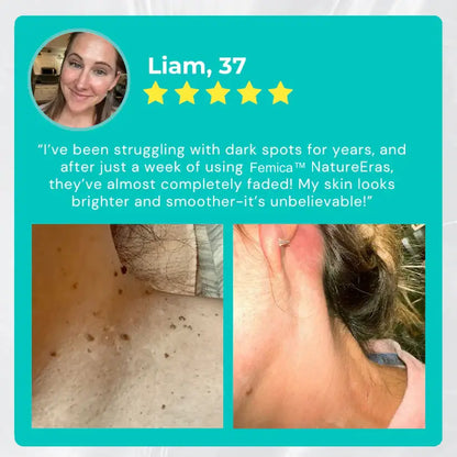 Femica™ NatureErase Instant Mole & Spot Cream