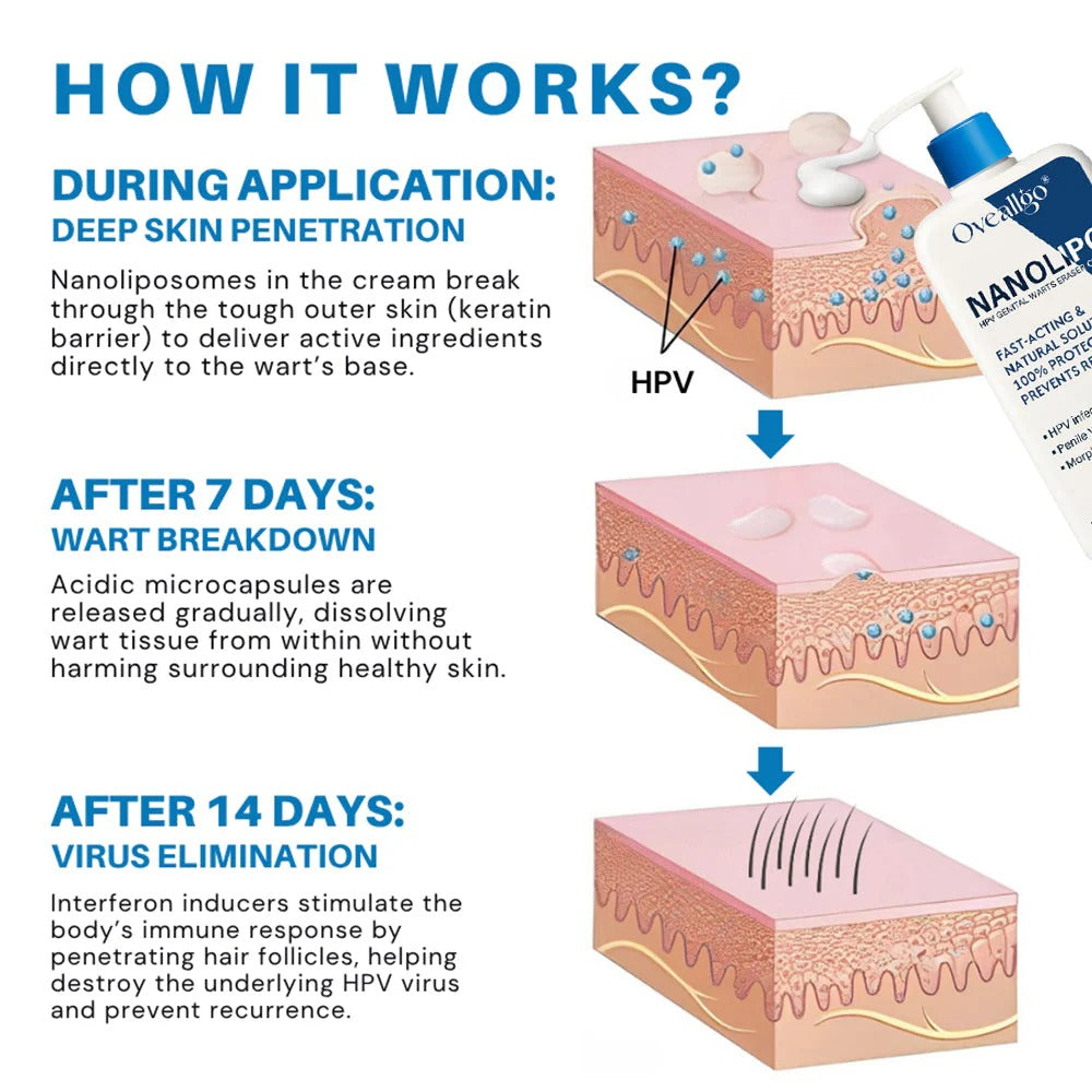 Oveallgo® NanoLipo HPV Genital Warts Eraser Cream