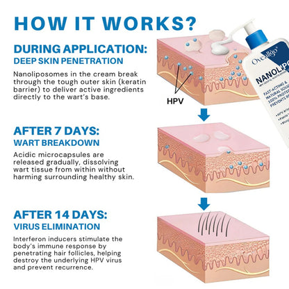 Oveallgo® NanoLipo HPV Genital Warts Eraser Cream
