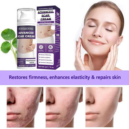 Kunauo™  Scar Removal Gel