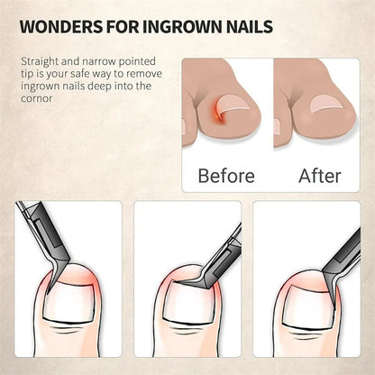 Kunauo™ Toenail Clipper Ingrown Nail Clipper