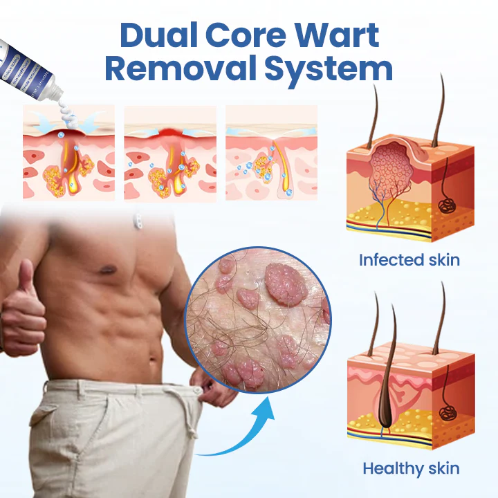 Kunauo® GentX WartRelief Cream