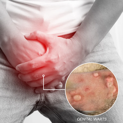 Kunauo® GentX WartRelief Cream