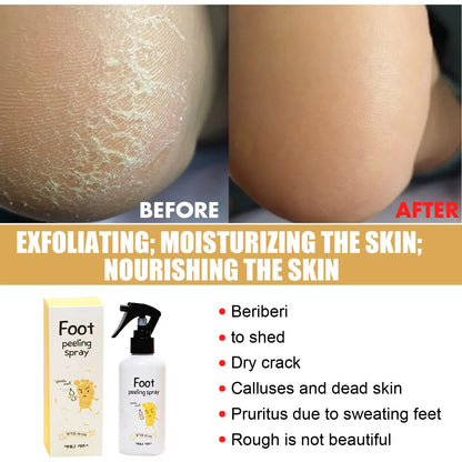 EELHOE™ Foot Peeling Spray