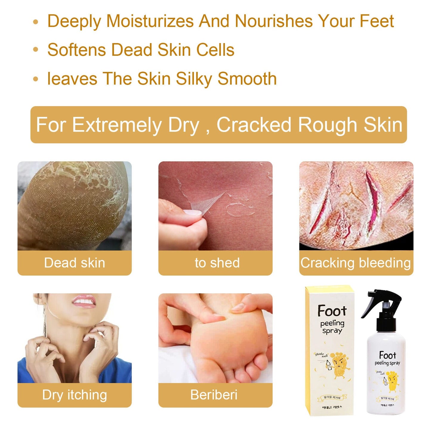 EELHOE™ Foot Peeling Spray