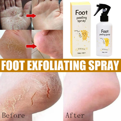 EELHOE™ Foot Peeling Spray